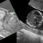 Scientists Search for the Dawn of Consciousness in Babies