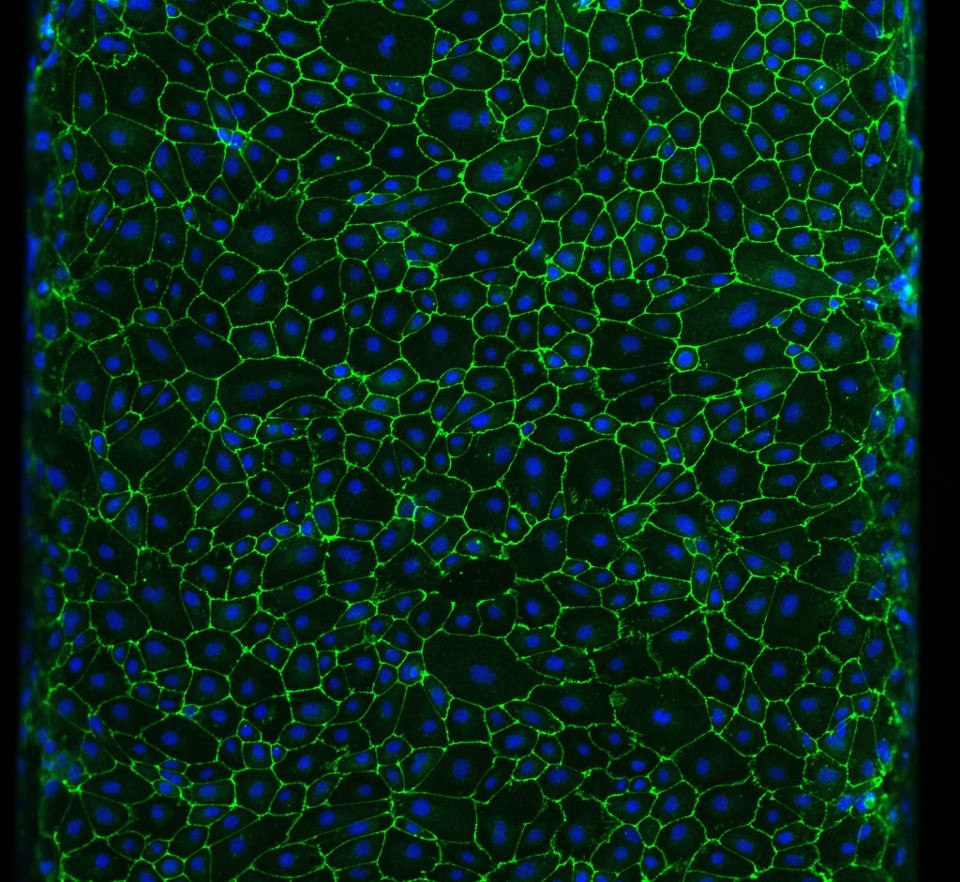 Mice With Human Brain Tissue Raise Hope and Ethics Concerns