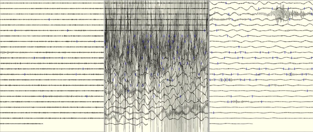 What Is a Seismic Swarm? Colombia's Chocó Quake Explained