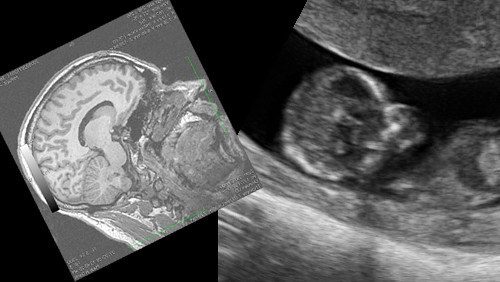 Scientists Search for the Dawn of Consciousness in Babies